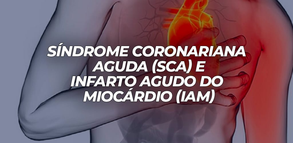 SINDROME CORONARIANA AGUDA atualizada